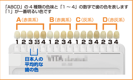 歯の話２６ あなたの歯の色はどんな色 医療法人白山歯科クリニック 小田原市足柄駅徒歩3分の歯医者