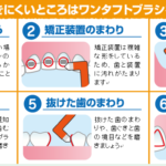 歯の話54 ドクターの9割がおすすめ 口臭予防にも効果的 ワンタフトブラシを使ってみよう 医療法人白山歯科クリニック 小田原市足柄駅徒歩3分の歯医者